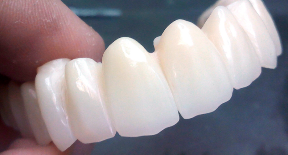 prótesis de zirconio