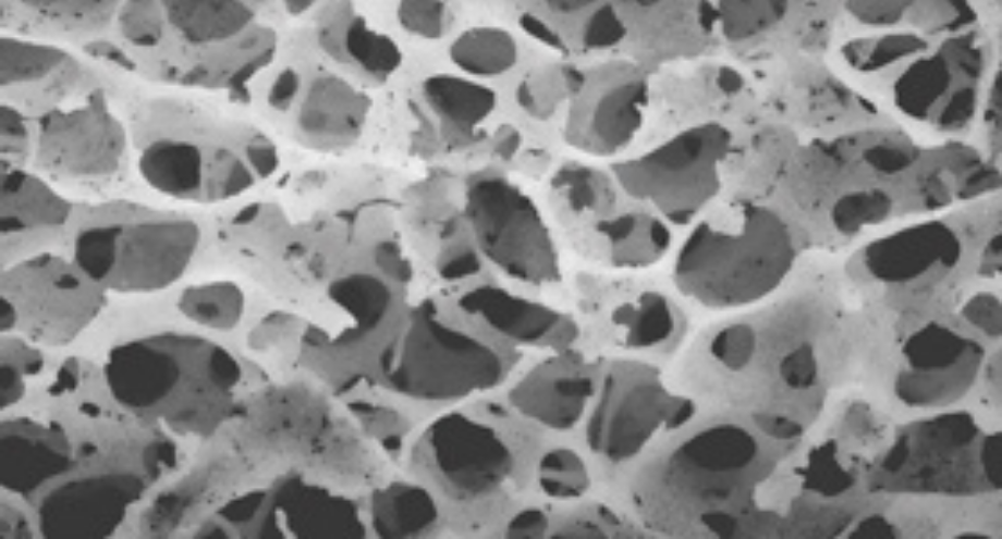 superficie de los implantes