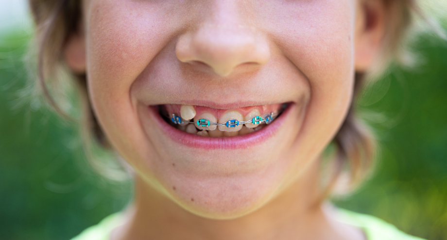 ortodoncia infantil
