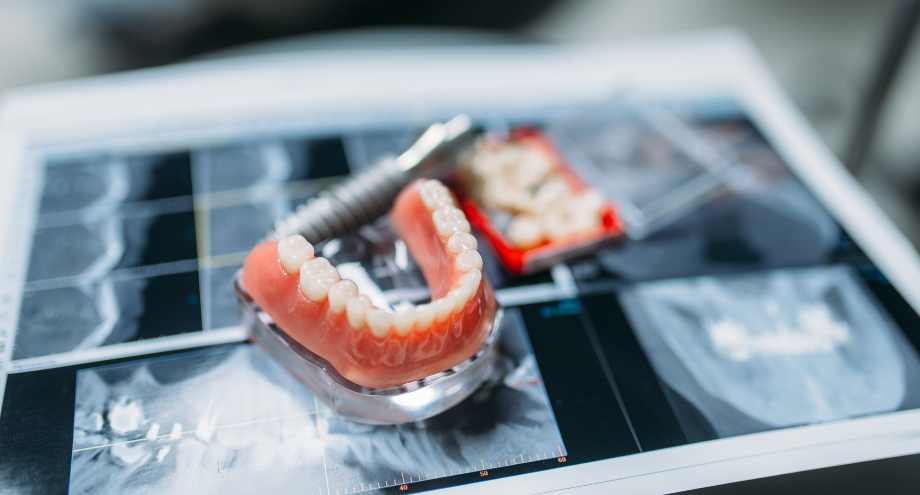 prótesis removibles