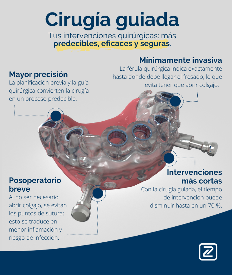 ventajas cirugía guiada implantología