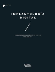 implantología digital