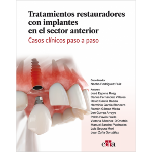tratamientos restauradores con implantes en el sector anterior