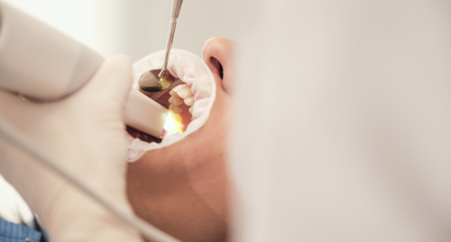 Escaneado dental 3D como parte del flujo digital