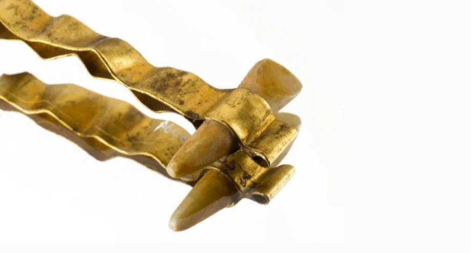 historia de la implantología oral