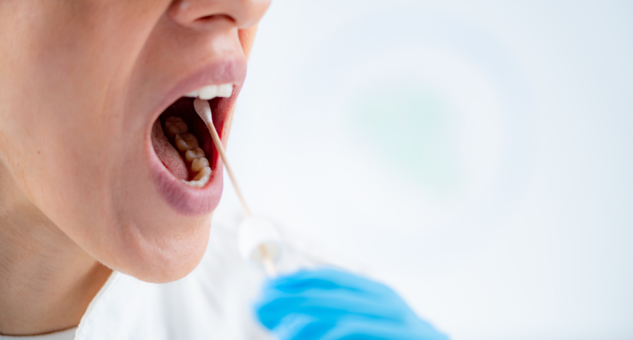 detección precoz de periodontitis