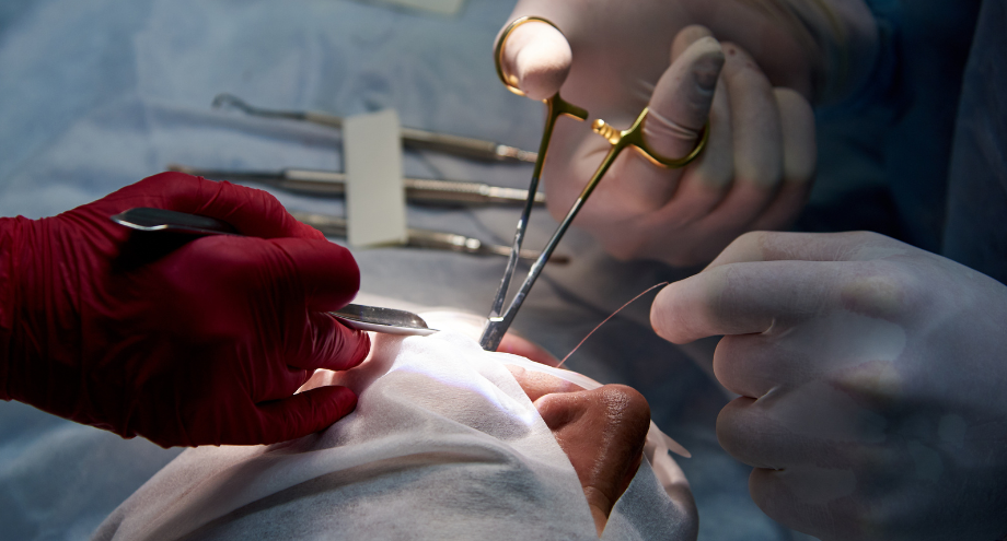 expansion-regeneracion-implantologia